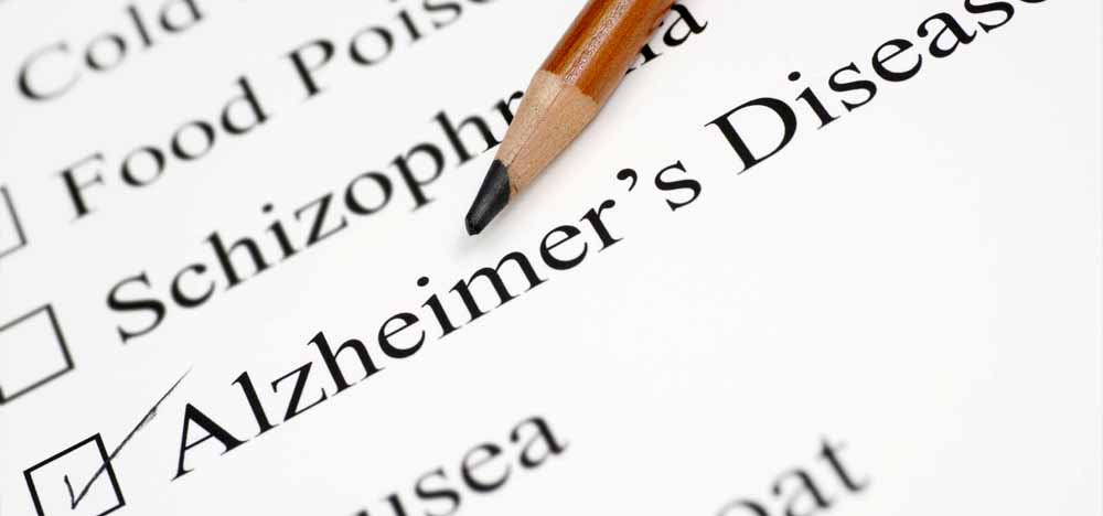 BS Dũng Trịnh Thuyết Trình Đề Tài Hội Chứng Alzheimer